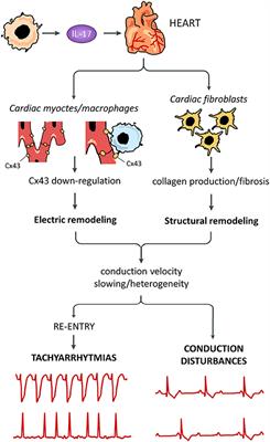 Commentary: Systemic effects of IL-17 in inflammatory arthritis